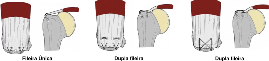 Técnicas de reparos