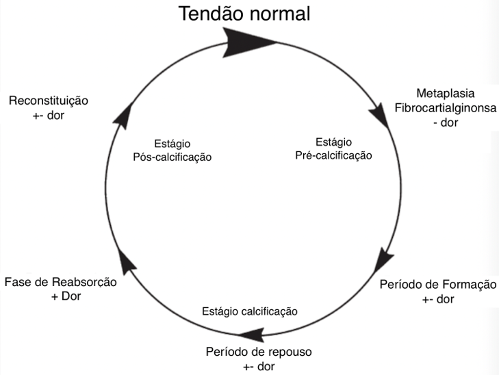 Tendão Normal
